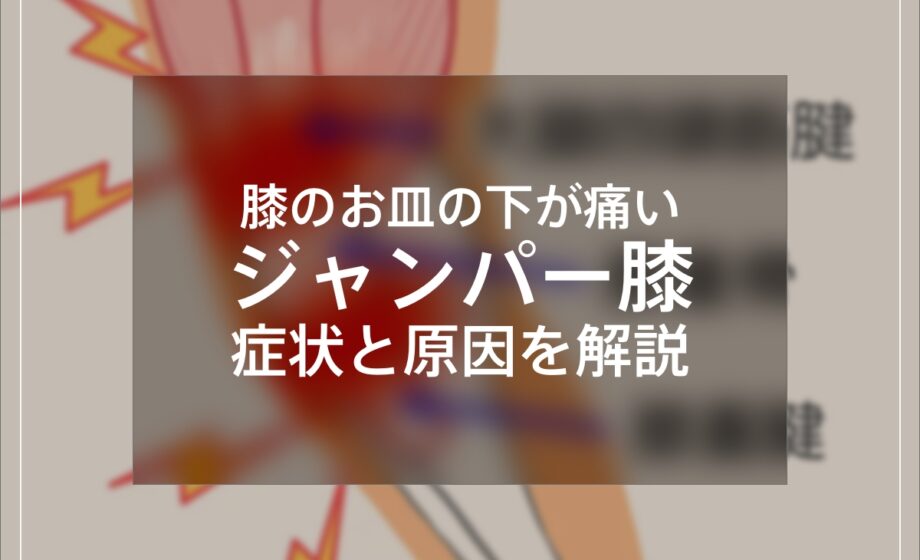 膝のお皿の下が痛い！ジャンパー膝の症状と原因を解説します。