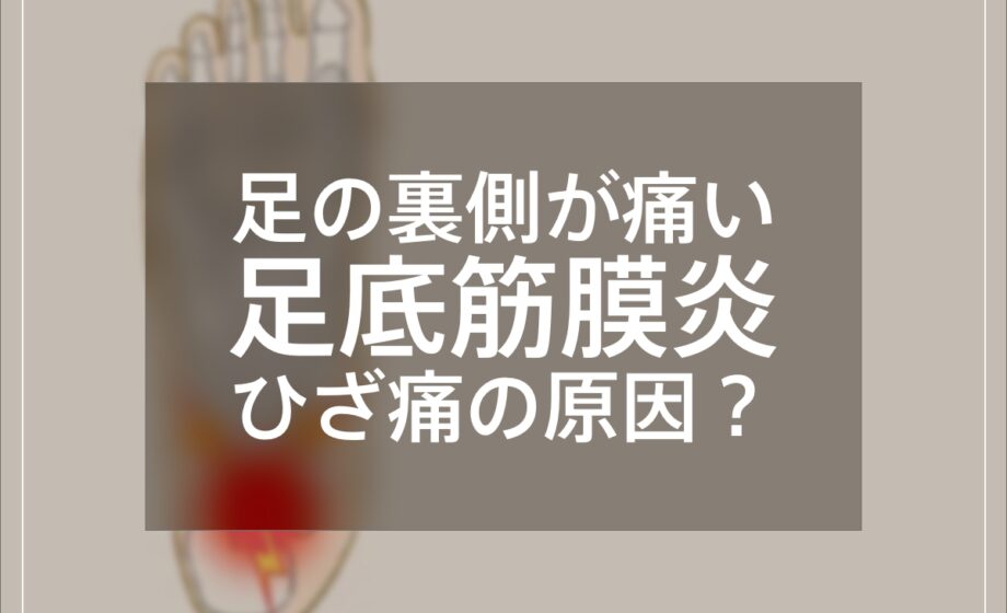 足の裏の痛みが膝痛の原因に？足底筋膜炎について解説