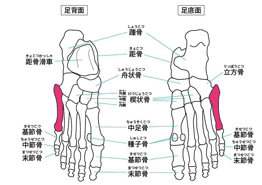 第五中足骨は足の指の付け根の骨で、小指側にあります。